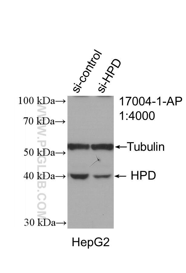 WB analysis of HepG2 using 17004-1-AP