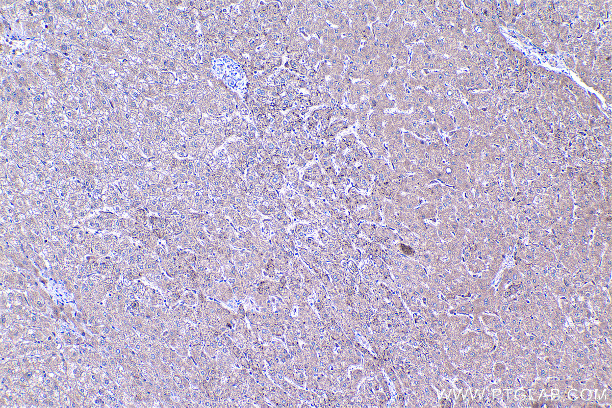 IHC staining of human liver using 20777-1-AP IHC staining of human liver using 20777-1-AP