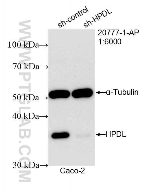 WB analysis of Caco-2 using 20777-1-AP