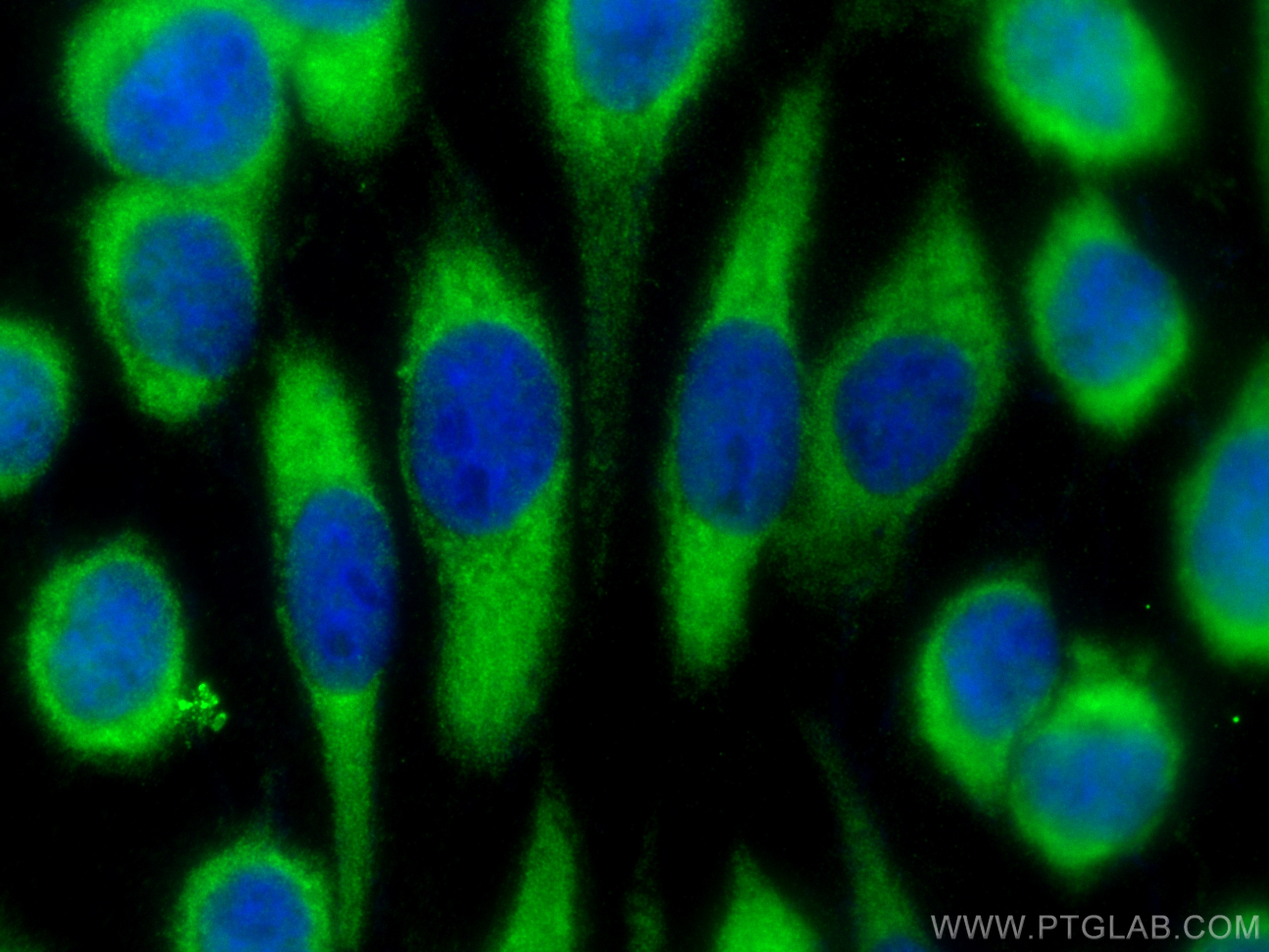 IF Staining of A431 using 28456-1-AP