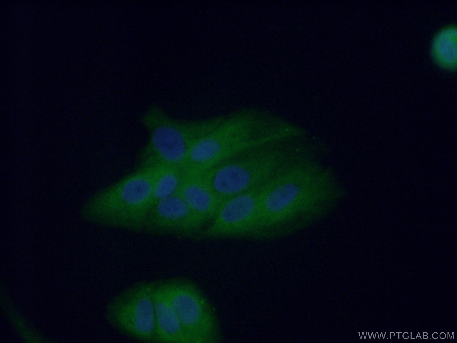 IF Staining of A549 using 11035-1-AP