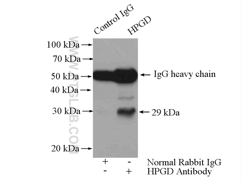 IP experiment of human placenta using 11035-1-AP