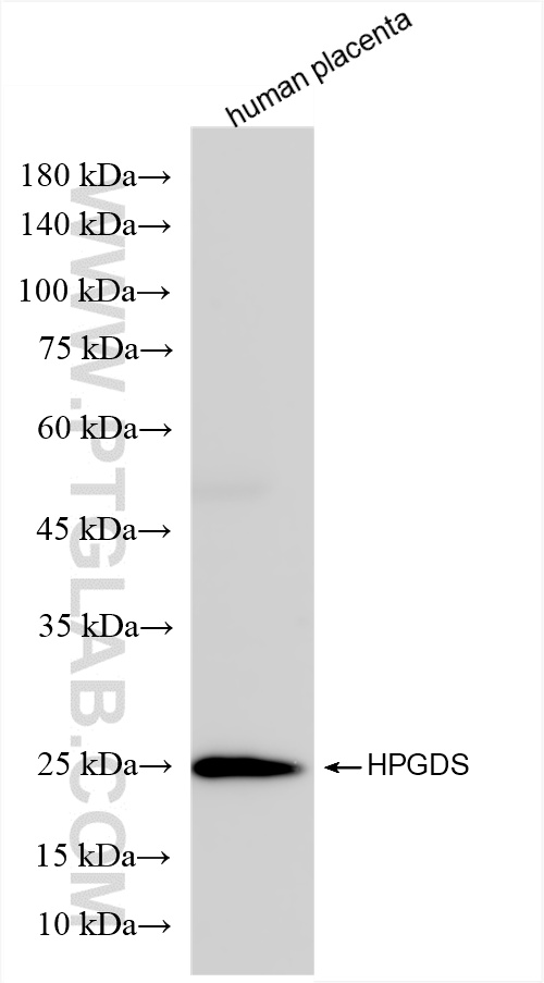 WB analysis of human placenta using 85446-2-RR (same clone as 85446-2-PBS)