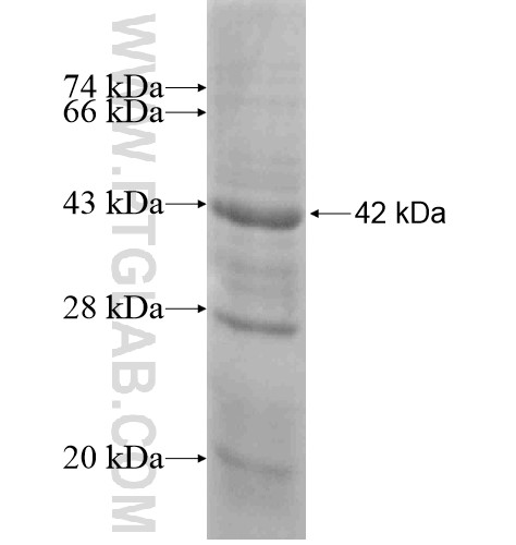HPN fusion protein Ag15103 SDS-PAGE HPN fusion protein Ag15103 SDS-PAGE