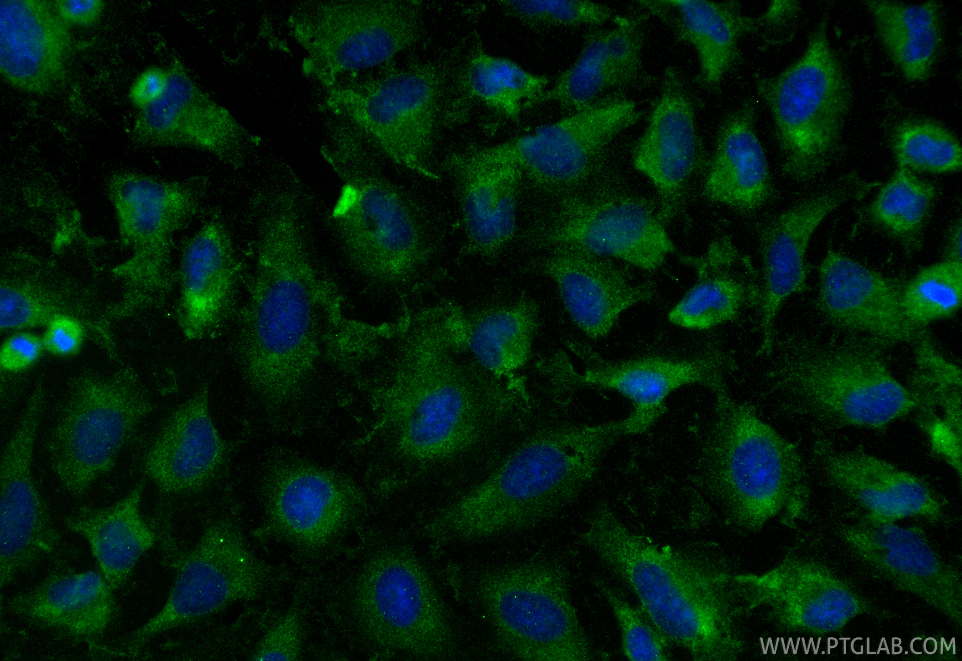 IF Staining of HeLa using RMX00095 IF Staining of HeLa using RMX00095