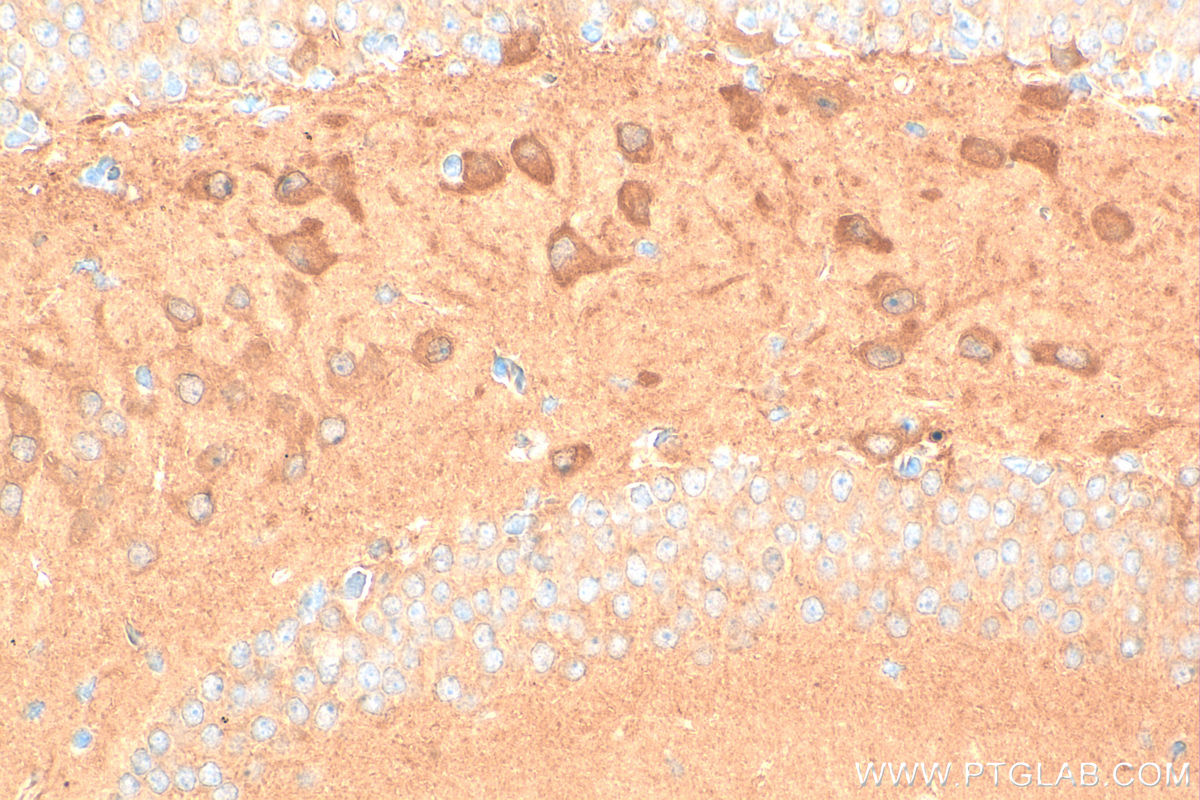 IHC staining of mouse brain using RMX00095 IHC staining of mouse brain using RMX00095