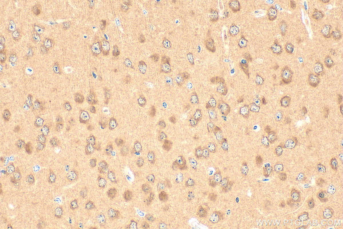 IHC staining of mouse brain using 15059-1-AP