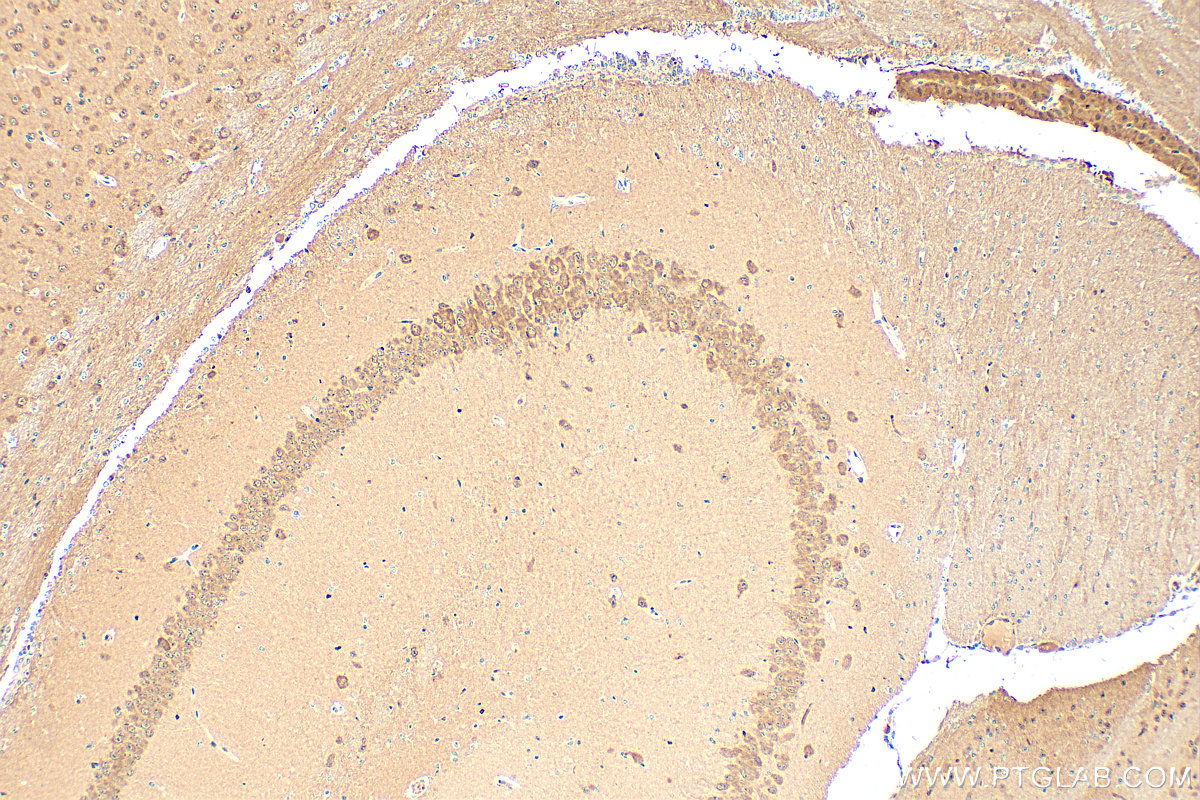 IHC staining of mouse brain using 15059-1-AP
