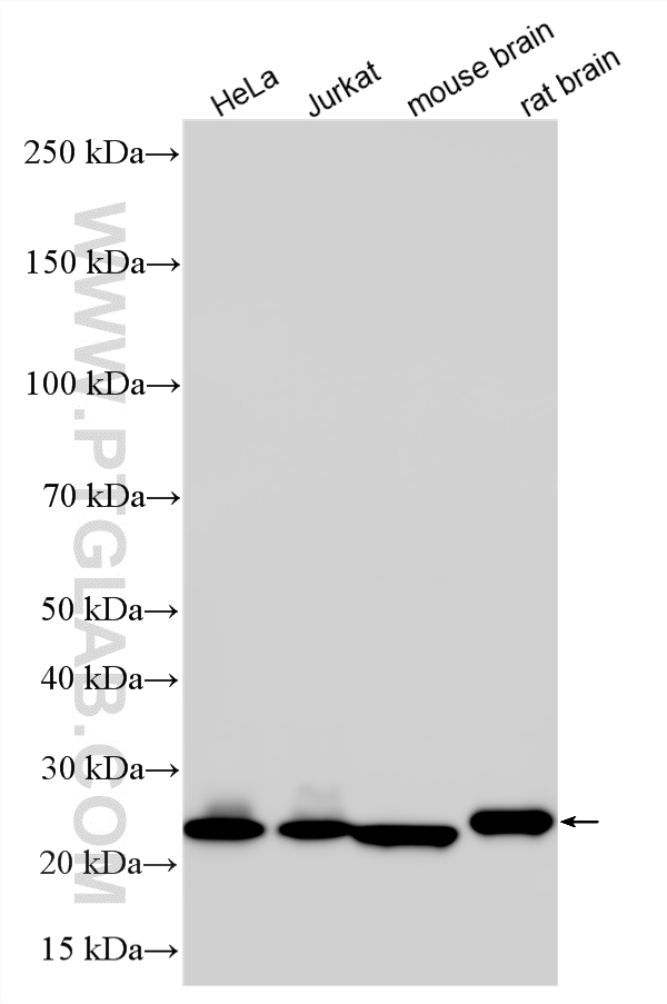 WB analysis using 15059-1-AP WB analysis using 15059-1-AP