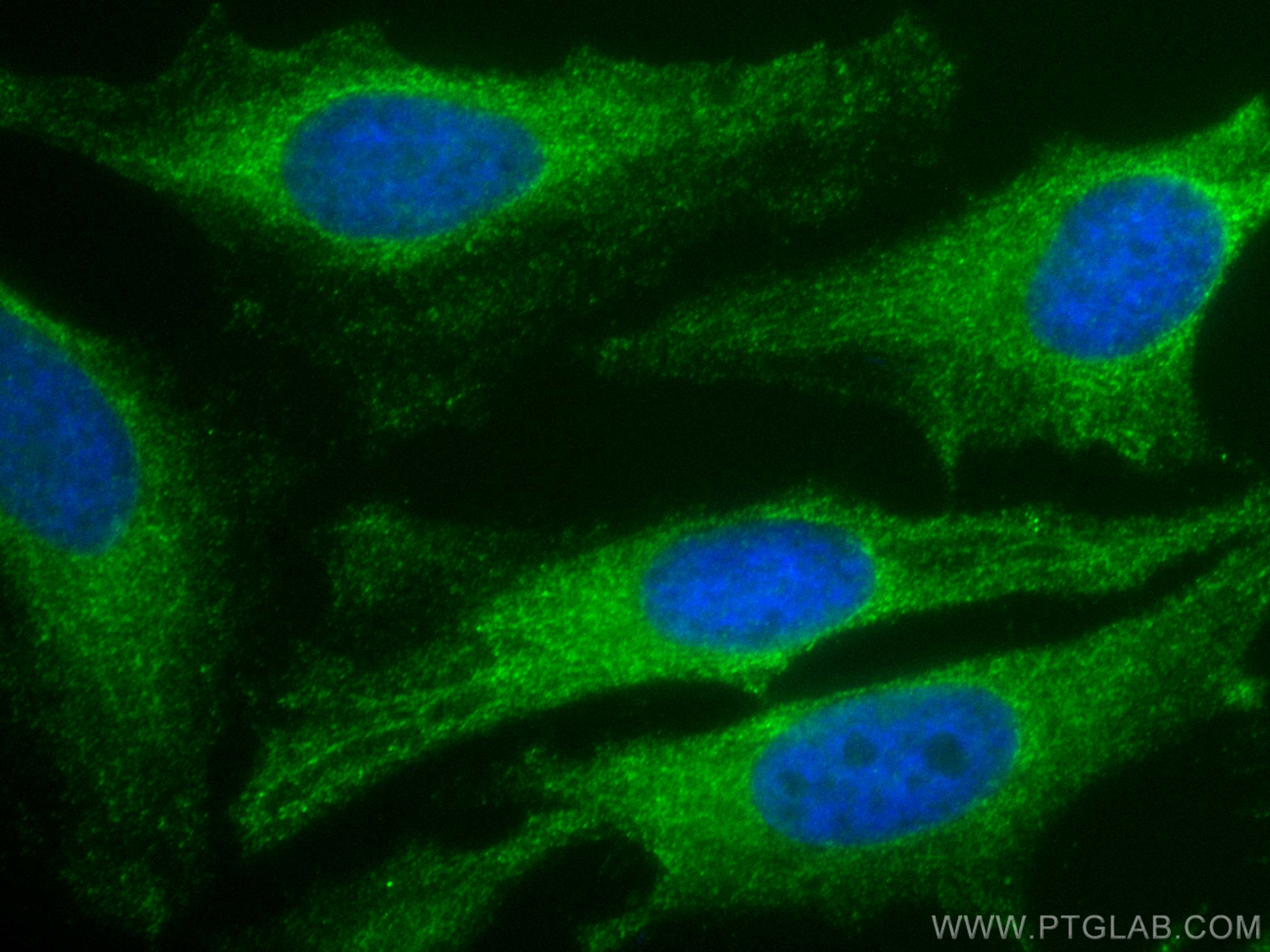 IF Staining of HeLa using CL488-67518