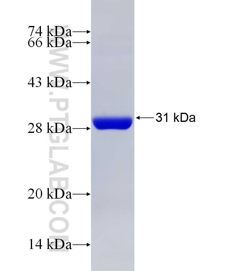 HPRT1 fusion protein Ag7044 SDS-PAGE