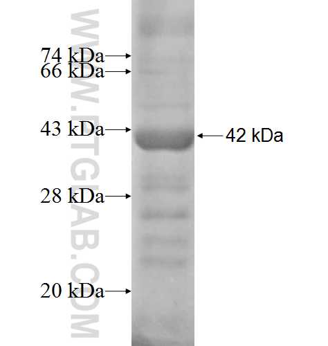HPS1 fusion protein Ag8111 SDS-PAGE