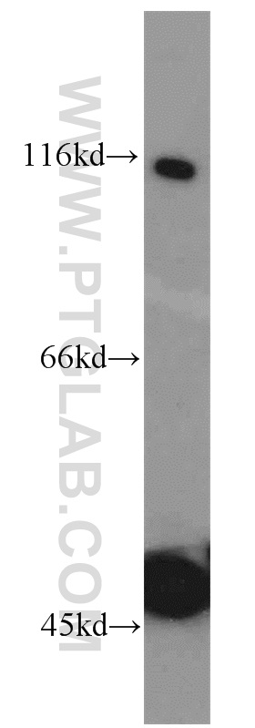 WB analysis of HeLa using 10768-1-AP