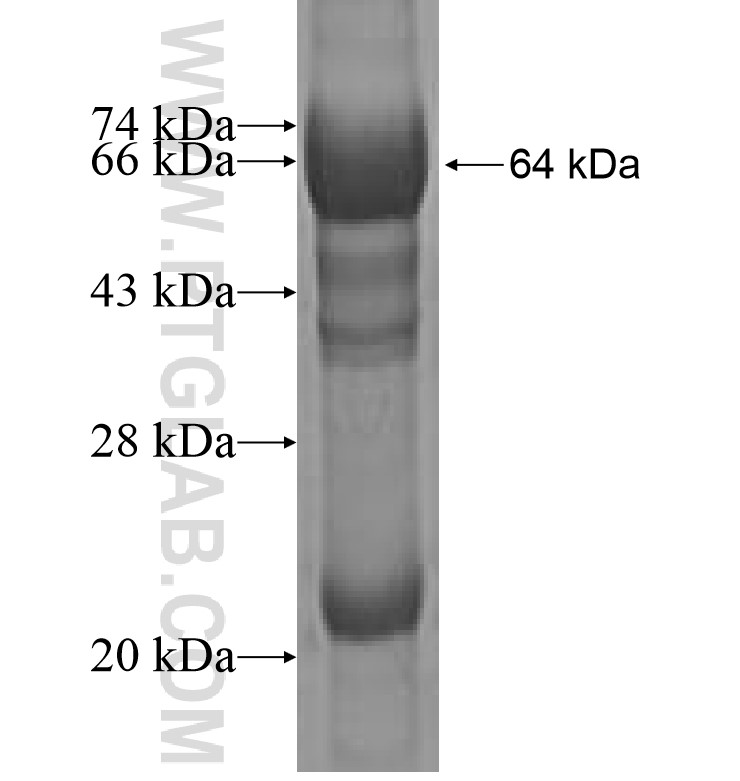 HPS3 fusion protein Ag1209 SDS-PAGE