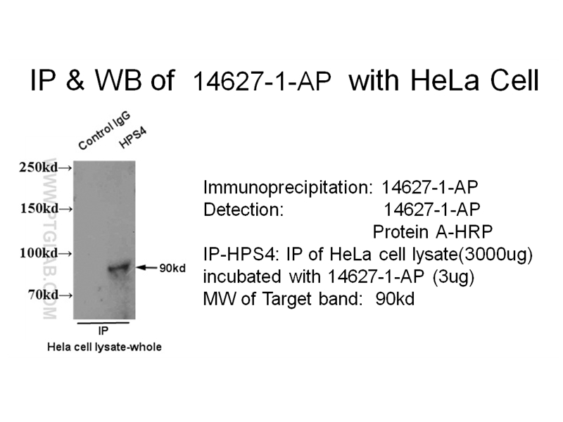 IP experiment of Hela cells using 14627-1-AP