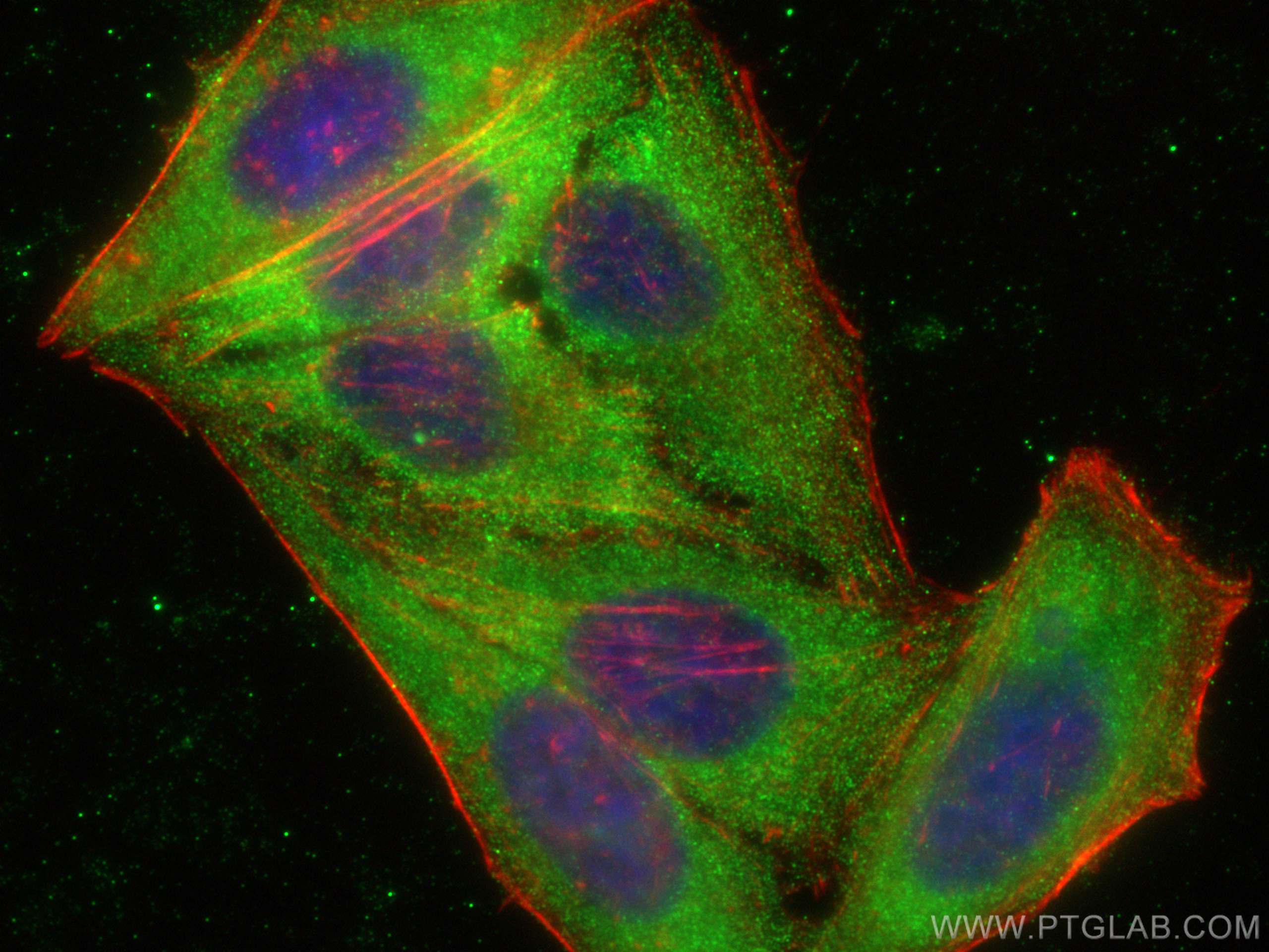 IF Staining of HepG2 using 14627-1-AP
