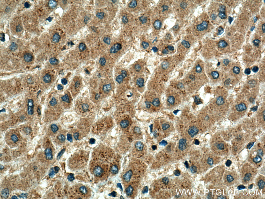 IHC staining of human liver using 14627-1-AP