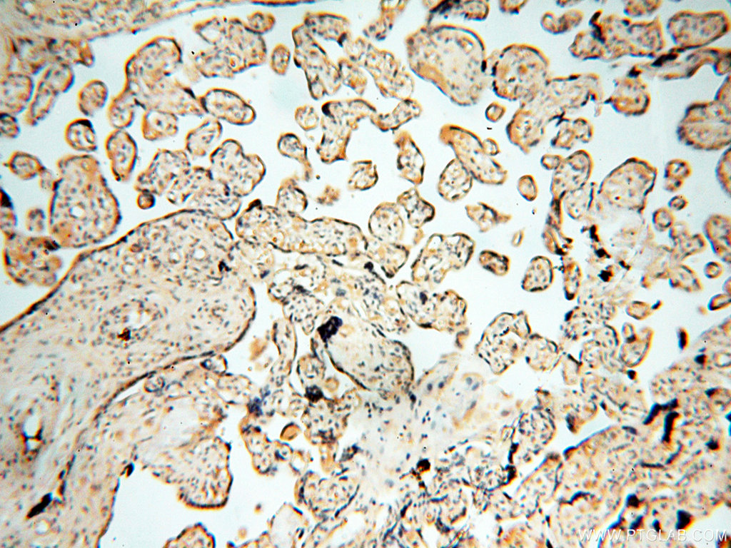 IHC staining of human placenta using 13901-1-AP (same clone as 13901-1-PBS)