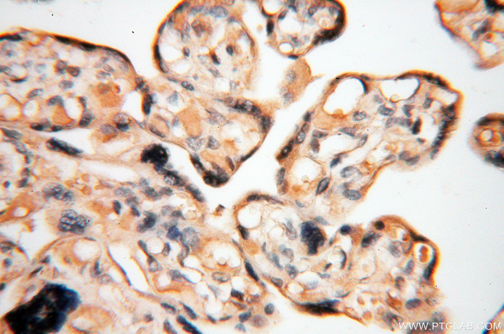 IHC staining of human placenta using 13901-1-AP (same clone as 13901-1-PBS)