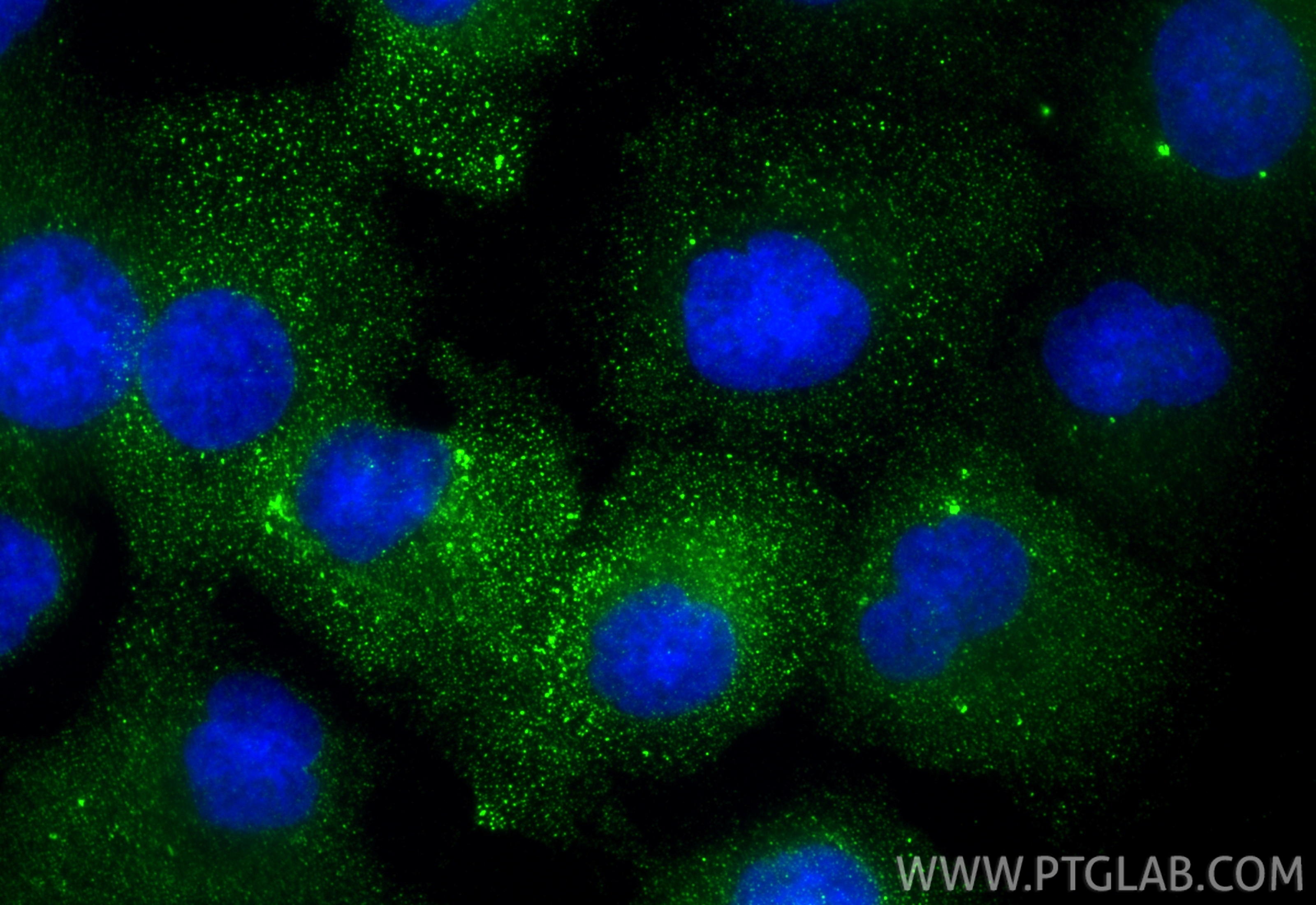 Immunofluorescent analysis of (4% PFA) fixed DU 145 cells using HPSE antibody (16673-1-AP) at dilution of 1:400 and CoraLite®488-Conjugated Goat Anti-Rabbit IgG(H+L) (<a class='green' href='/productredirect?CatalogNo=SA00013-2' target='_blank'>SA00013-2</a>). IF Staining of DU 145 using 16673-1-AP