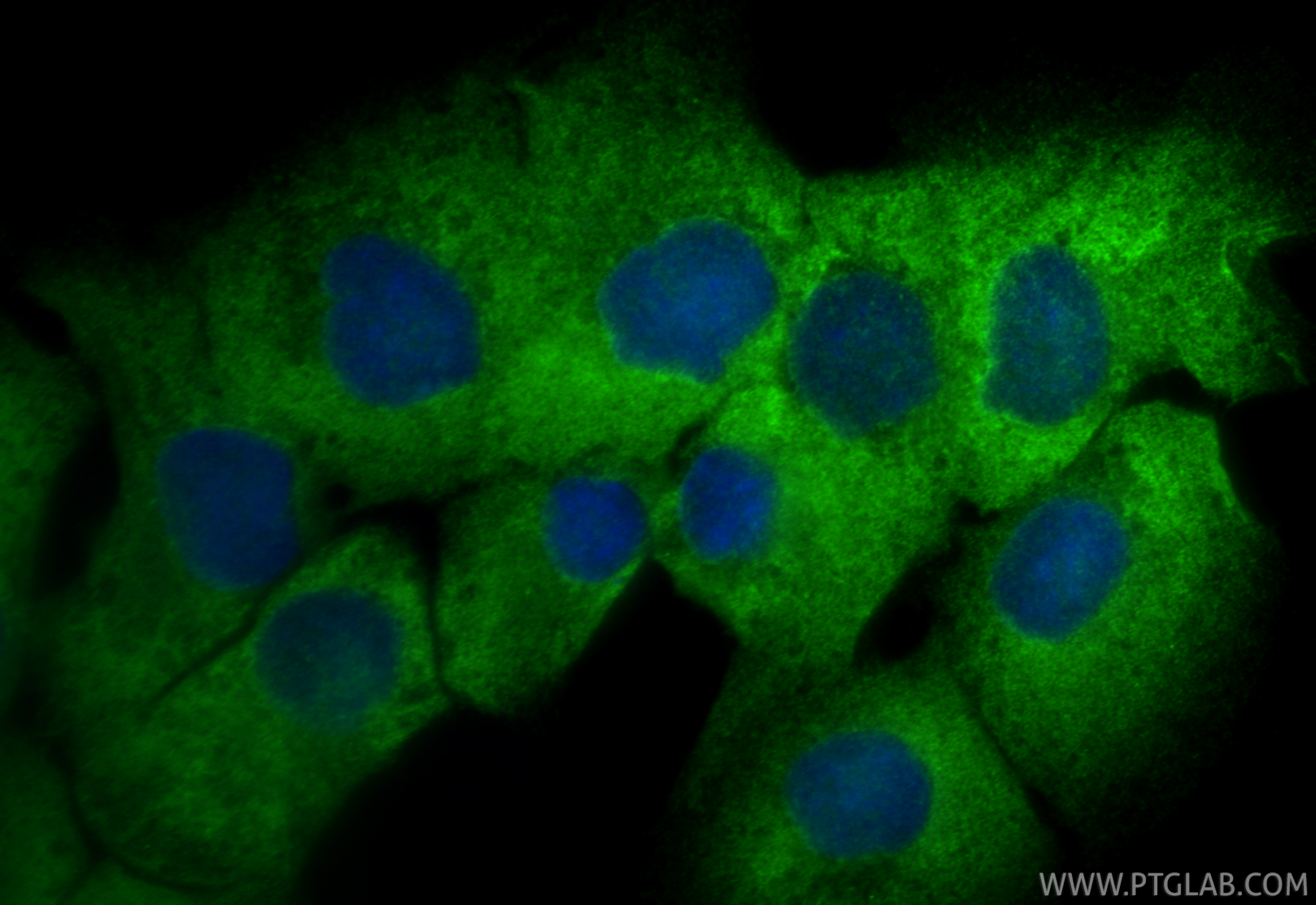 Immunofluorescent analysis of (4% PFA) fixed DU 145 cells using HPSE antibody (24529-1-AP) at dilution of 1:400 and CoraLite®488-Conjugated Goat Anti-Rabbit IgG(H+L) (<a class='green' href='/productredirect?CatalogNo=SA00013-2' target='_blank'>SA00013-2</a>). IF Staining of DU 145 using 24529-1-AP