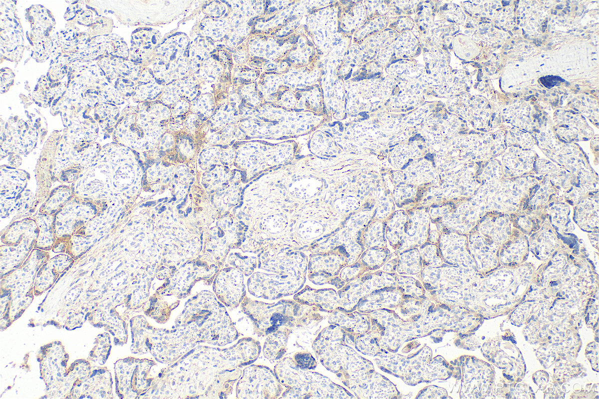 IHC staining of human placenta using 84562-1-RR