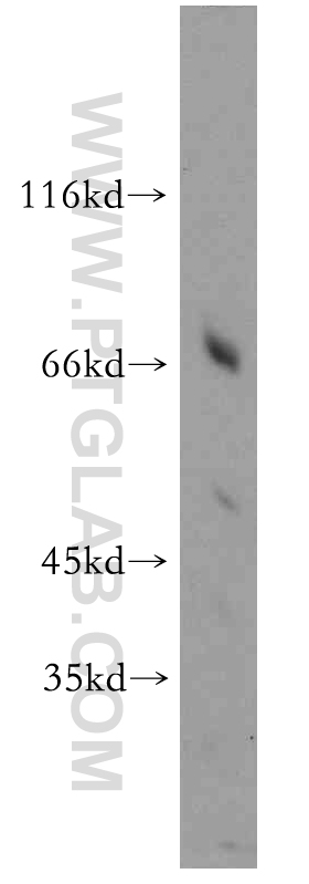 WB analysis of L02 using 21128-1-AP