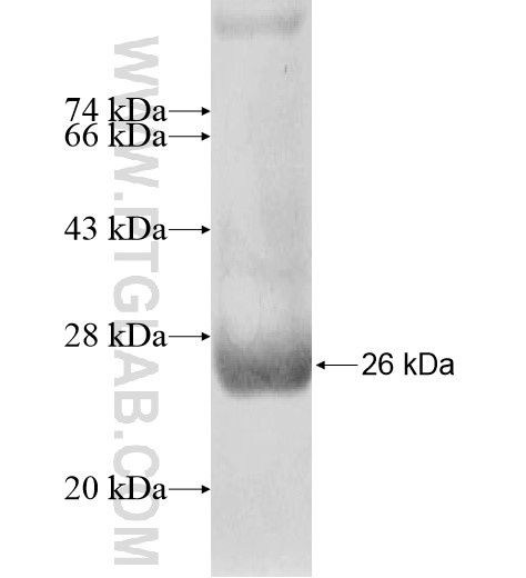 HPSE2 fusion protein Ag15179 SDS-PAGE HPSE2 fusion protein Ag15179 SDS-PAGE