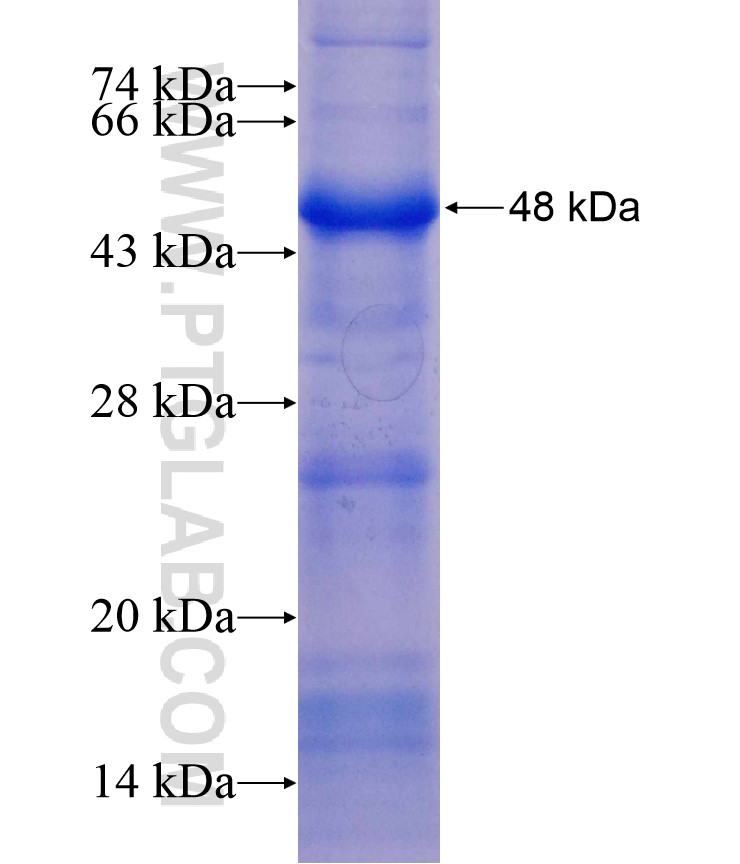 HR fusion protein Ag16992 SDS-PAGE HR fusion protein Ag16992 SDS-PAGE