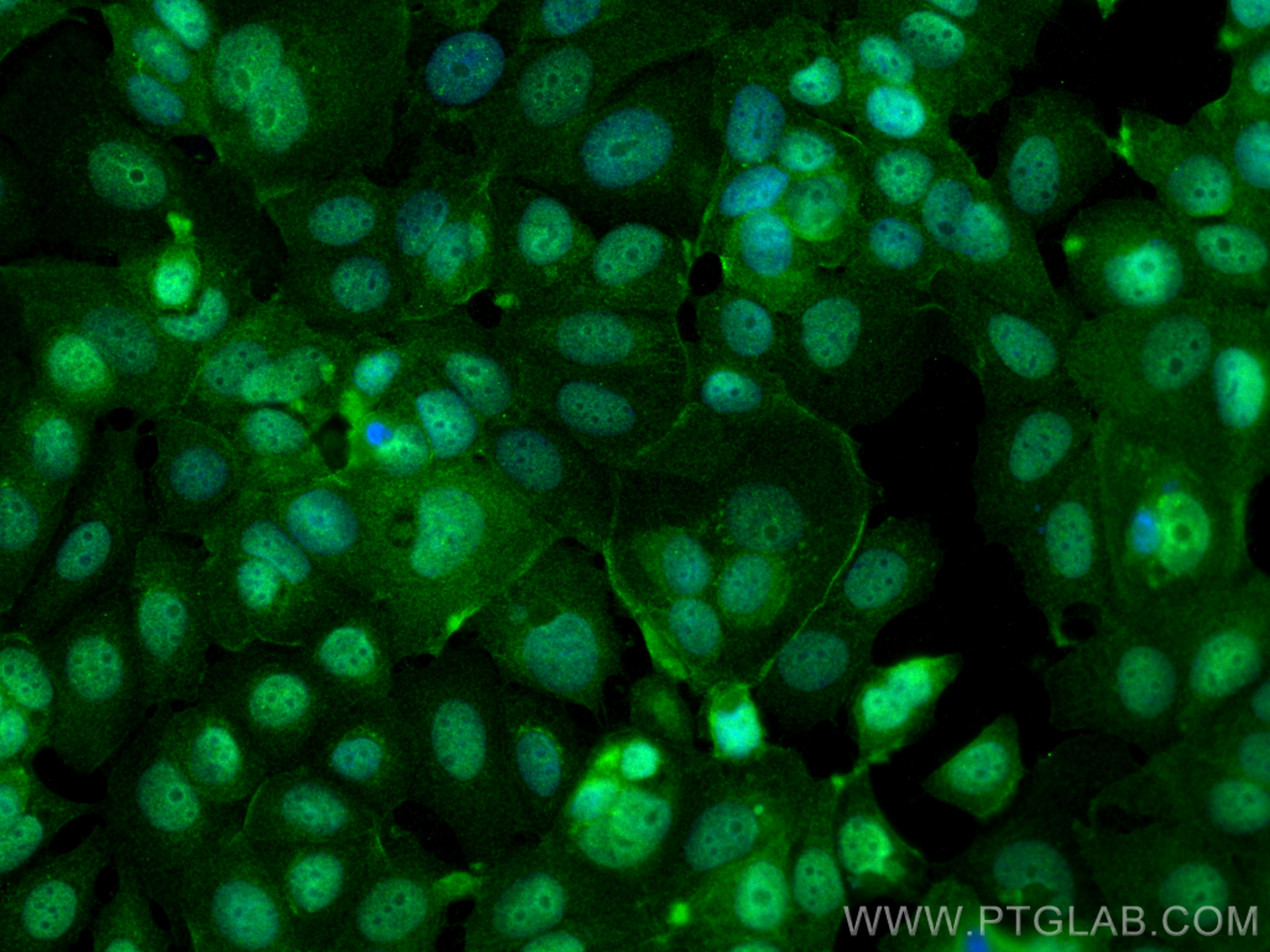 IF Staining of MCF-7 using 18295-1-AP