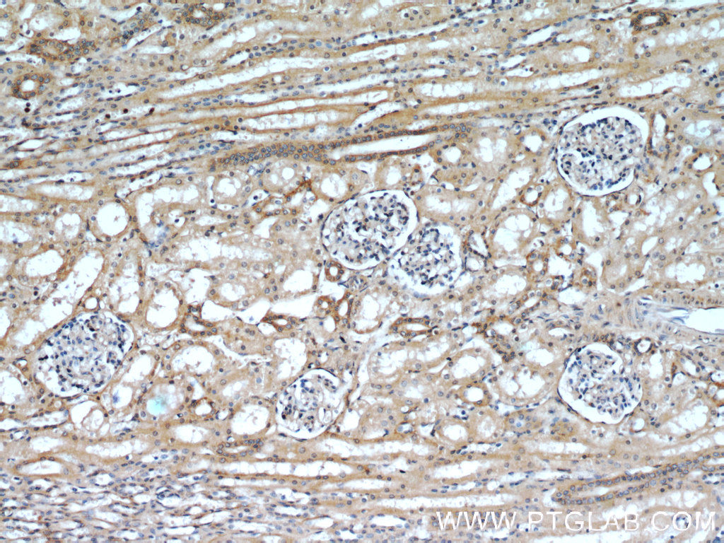 IHC staining of human kidney using 18295-1-PBS