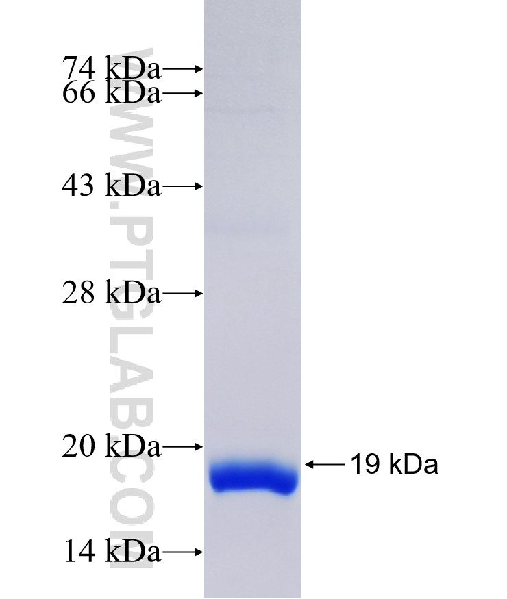 HRASLS fusion protein Ag38343 SDS-PAGE HRASLS fusion protein Ag38343 SDS-PAGE