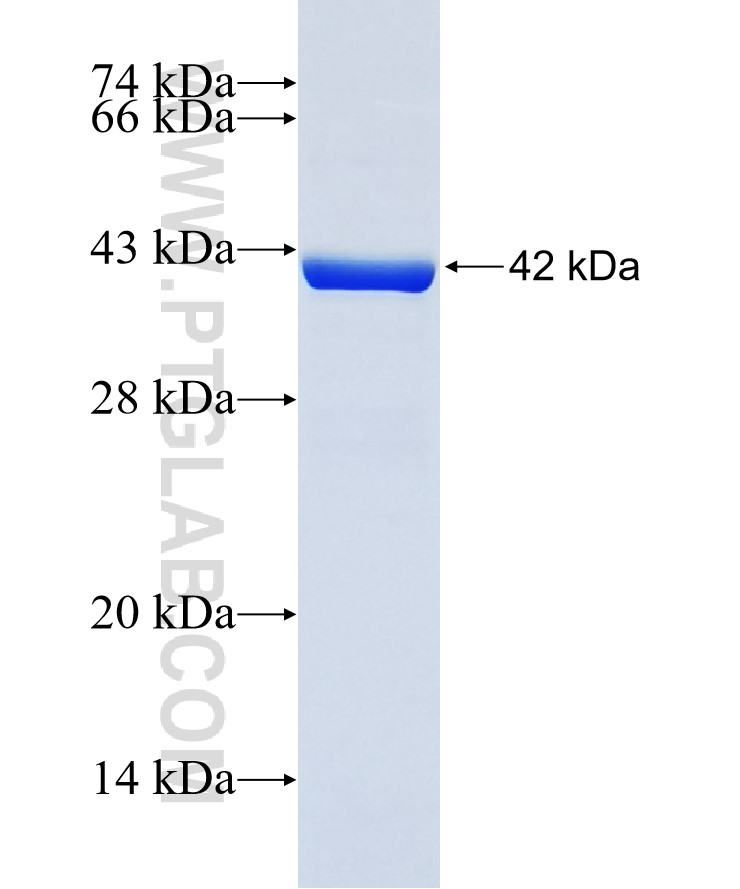 HRASLS fusion protein Ag38491 SDS-PAGE HRASLS fusion protein Ag38491 SDS-PAGE