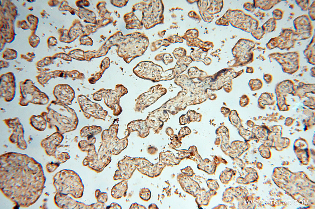 IHC staining of human placenta using 17581-1-AP (same clone as 17581-1-PBS)