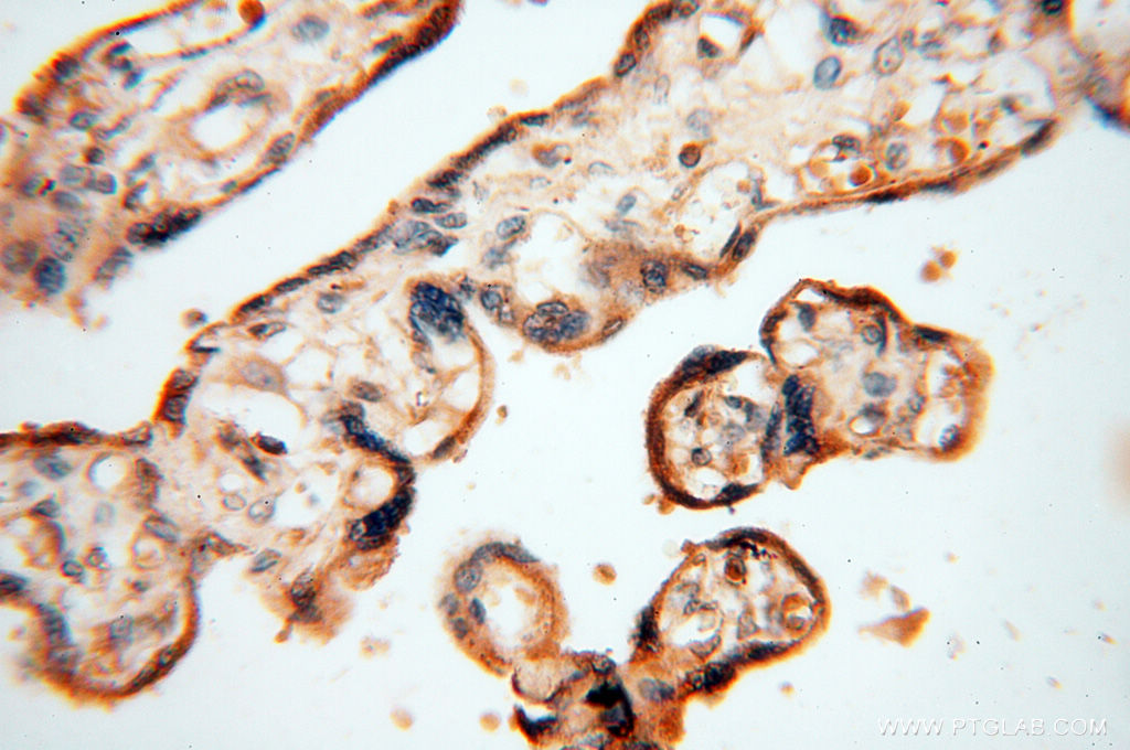 IHC staining of human placenta using 17581-1-AP (same clone as 17581-1-PBS)