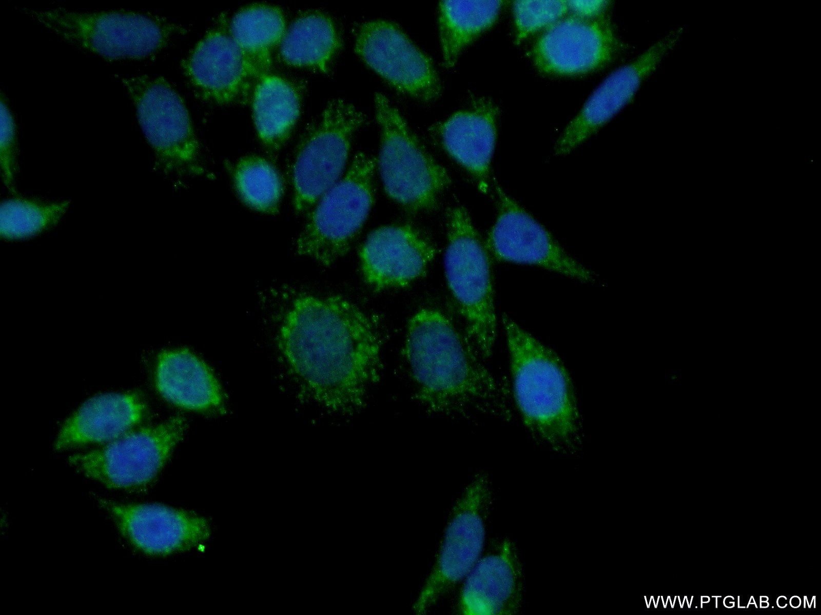 IF Staining of HeLa using 18142-1-AP