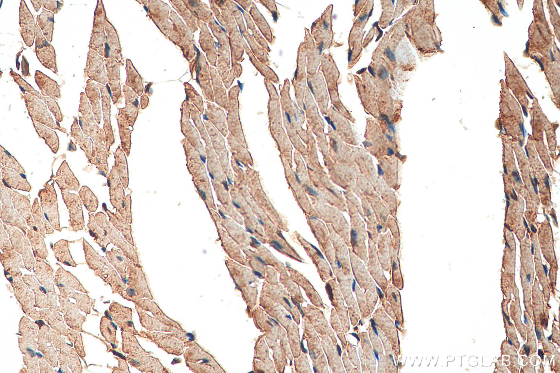 IHC staining of mouse heart using 18142-1-AP