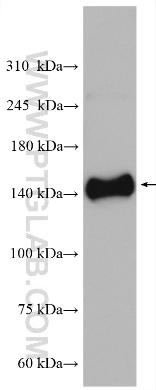 WB analysis of mouse heart using 18142-1-AP