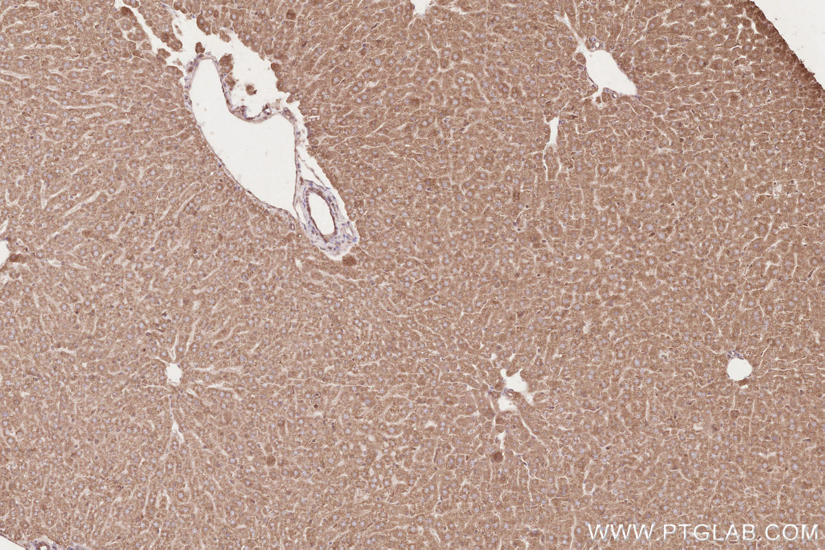 IHC staining of mouse liver using 67488-1-Ig