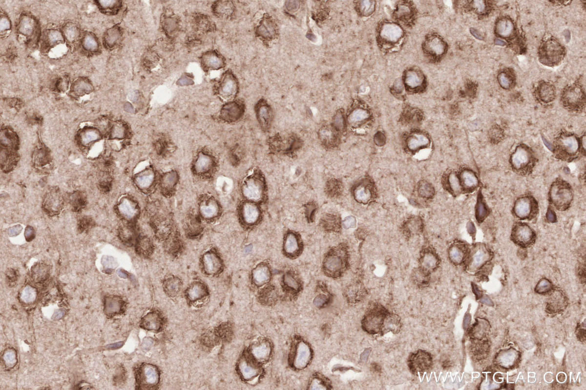 IHC staining of mouse brain using 67488-1-Ig