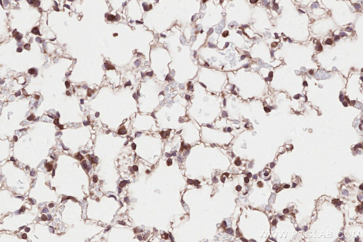 IHC staining of mouse lung using 67488-1-Ig
