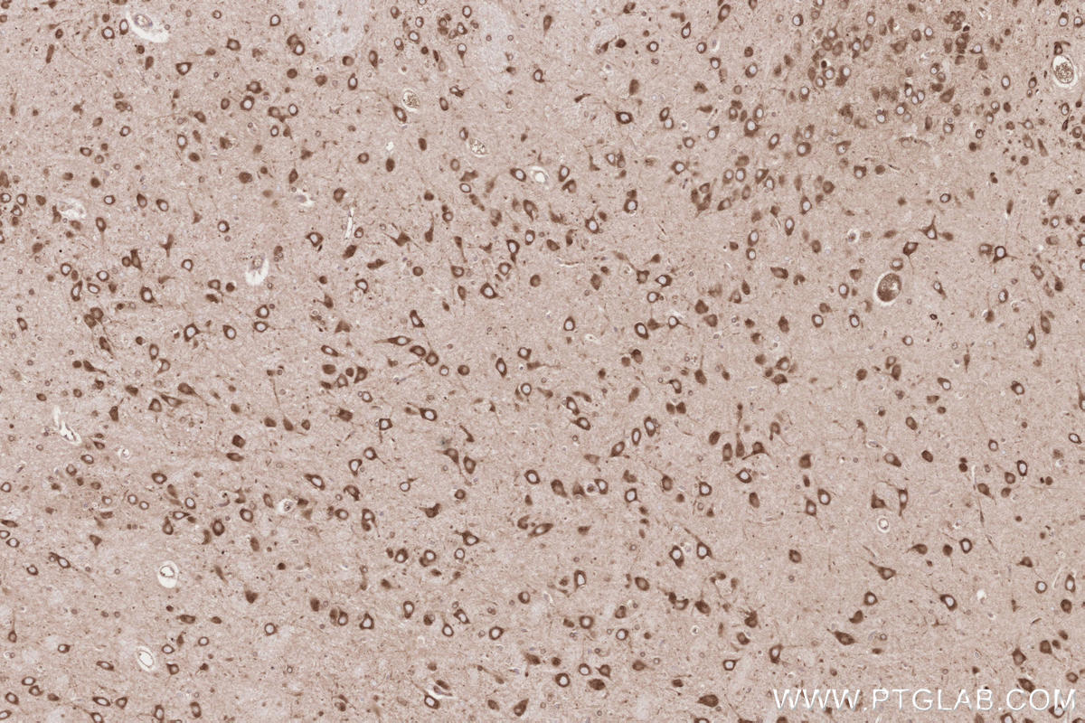 IHC staining of rat brain using 67488-1-Ig