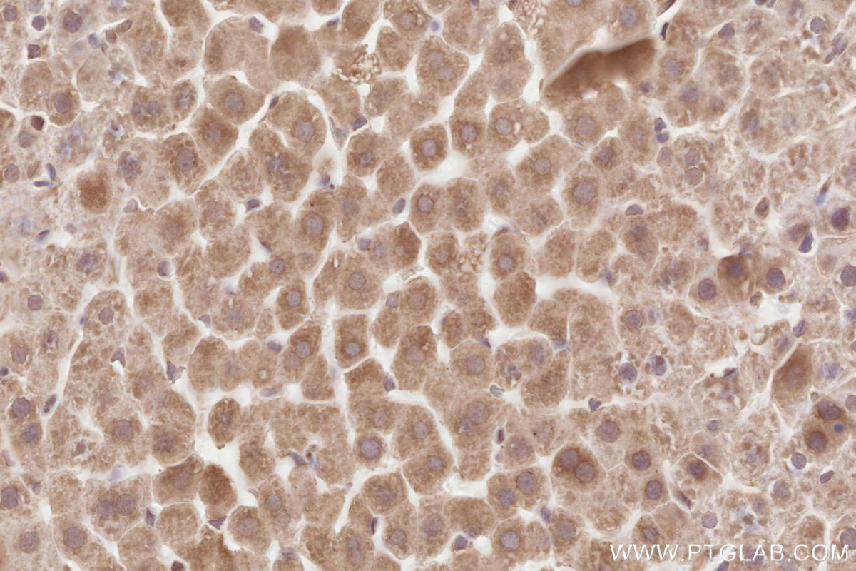 IHC staining of rat liver using 67488-1-Ig