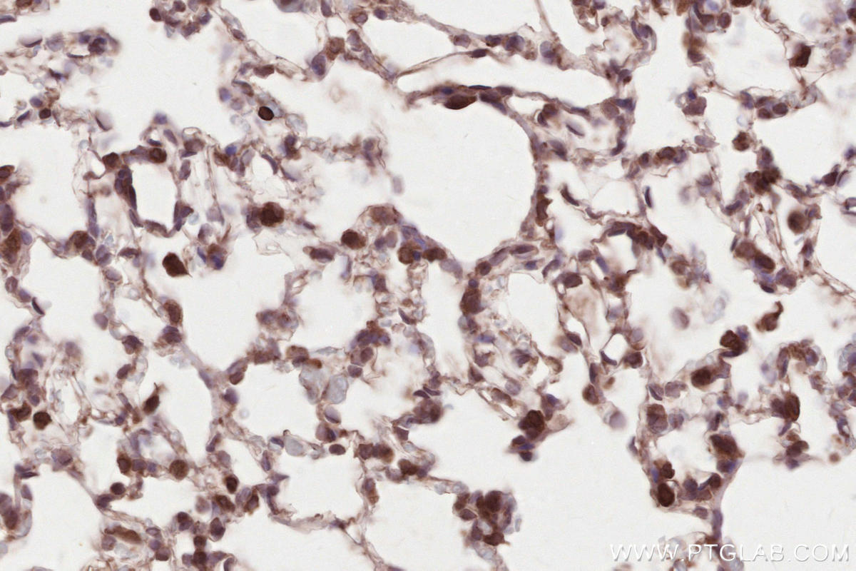 IHC staining of rat lung using 67488-1-Ig