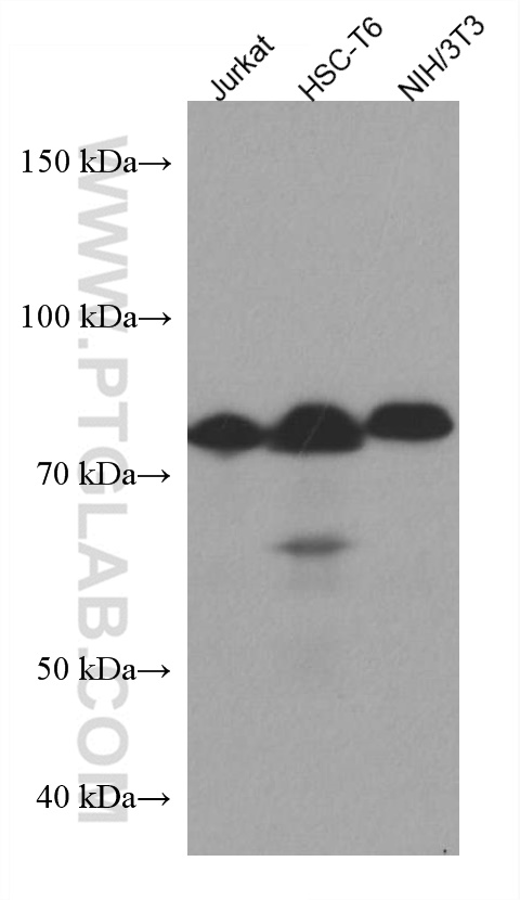 HRD1/SYVN1