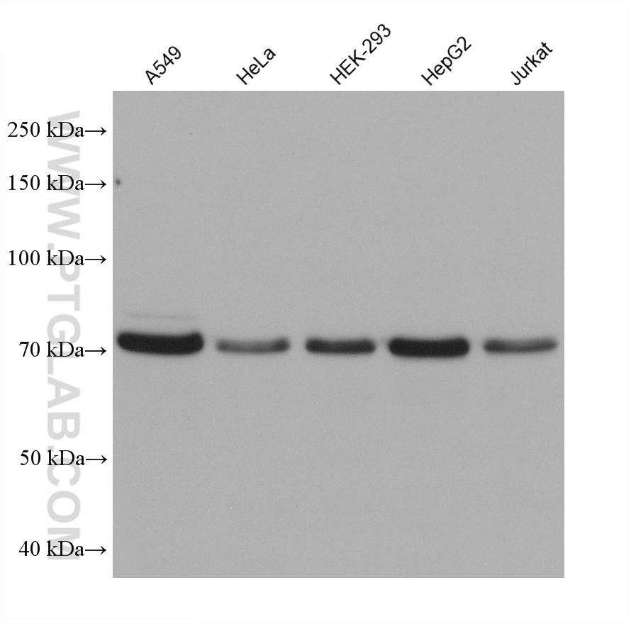 WB analysis using 67488-1-Ig