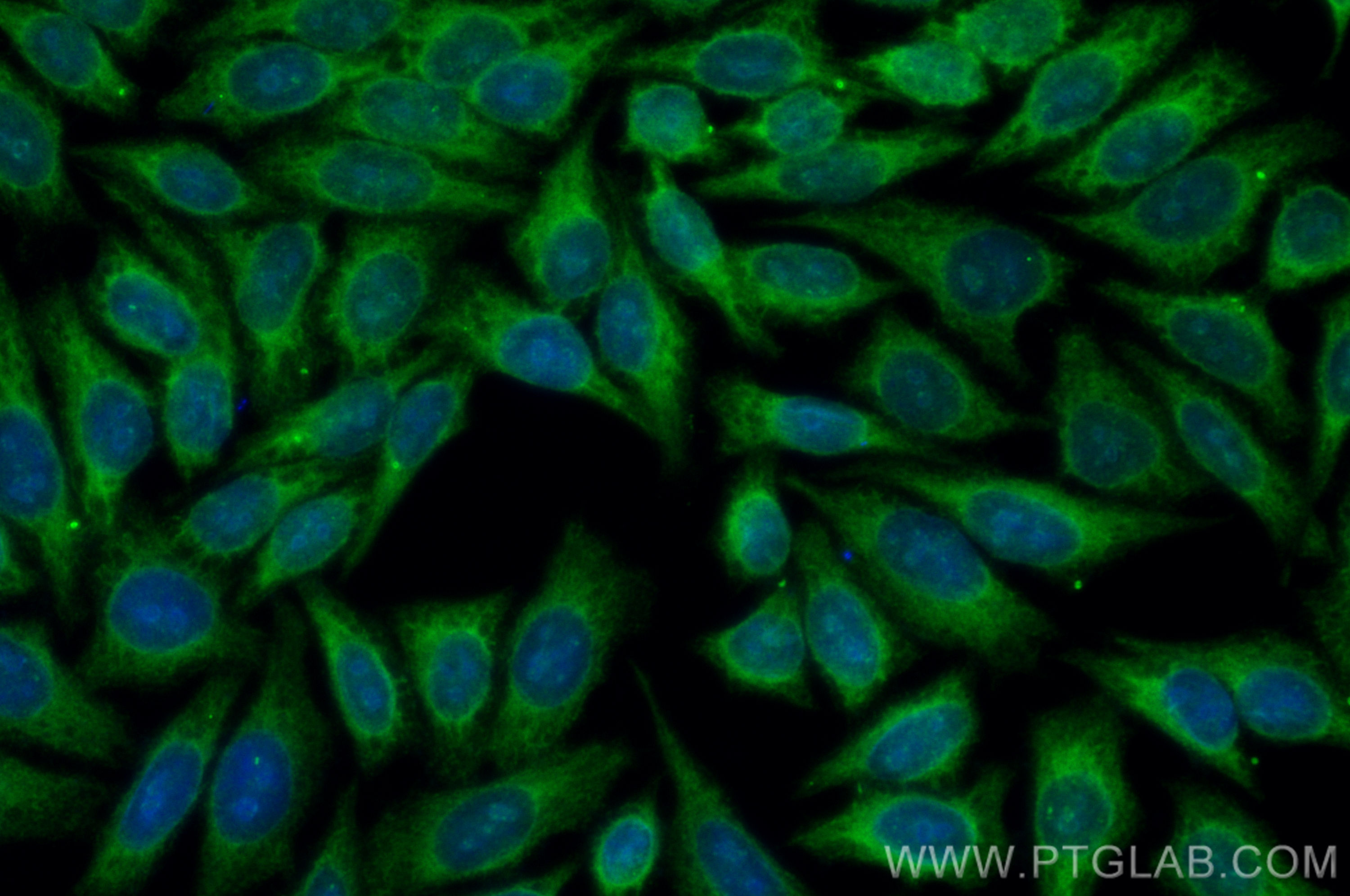 IF Staining of HepG2 using CL488-13473