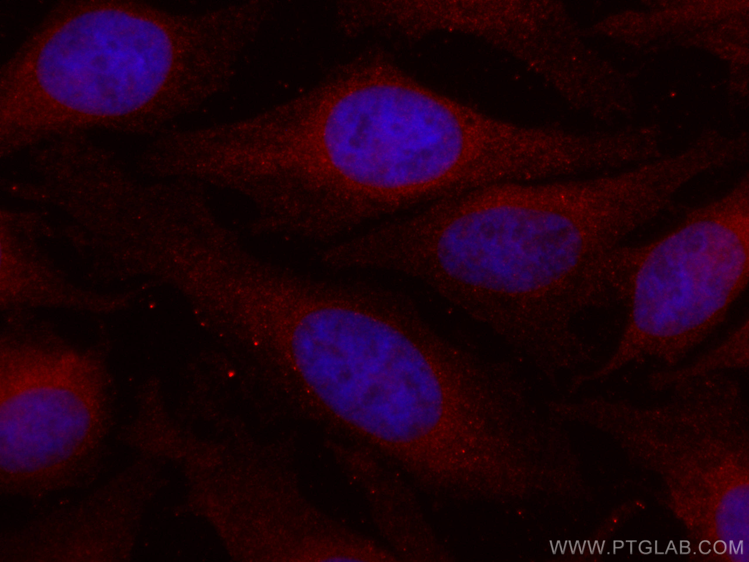 IF Staining of HeLa using CL594-67488