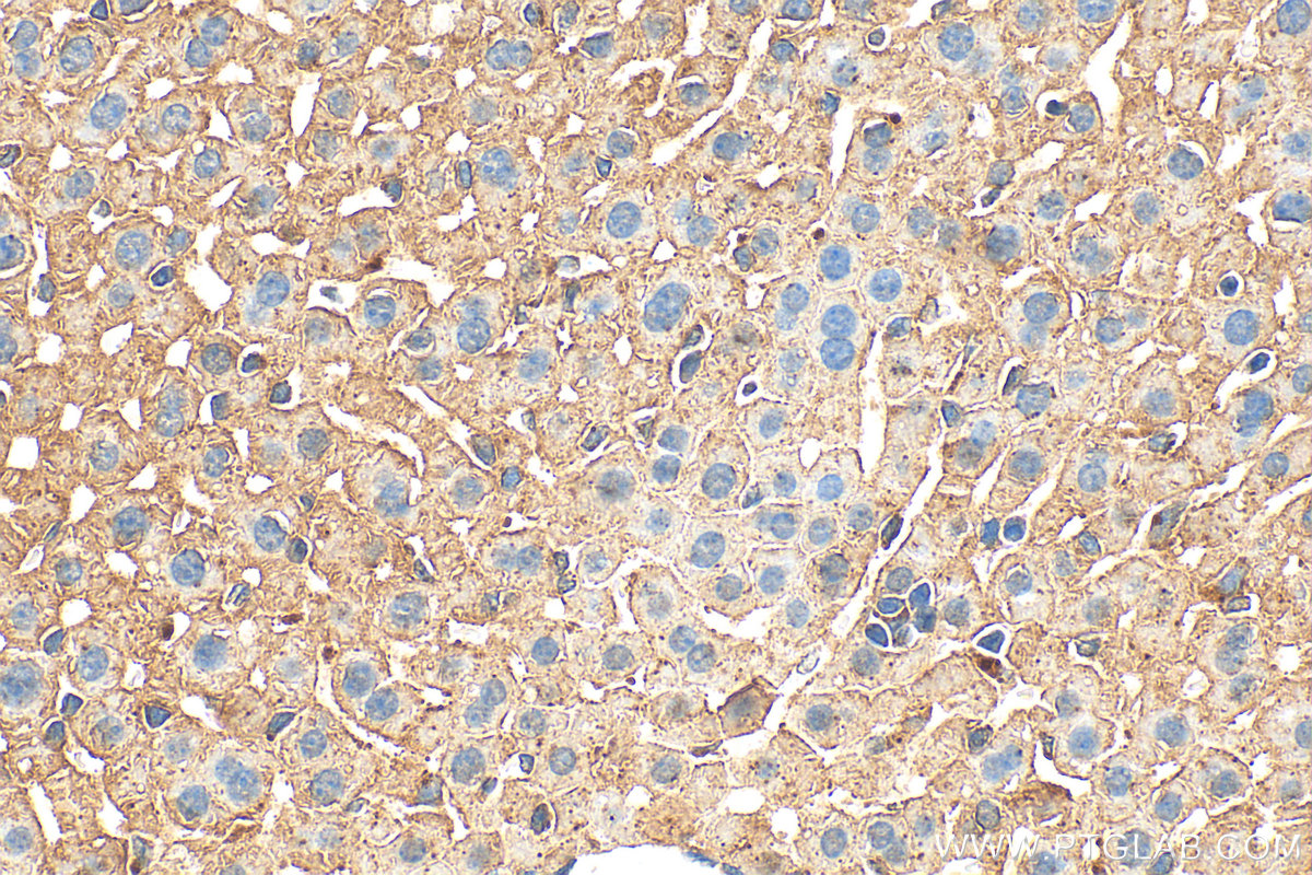 IHC staining of mouse liver using 28763-1-AP