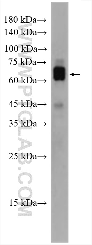 WB analysis of rat brain using 28763-1-AP